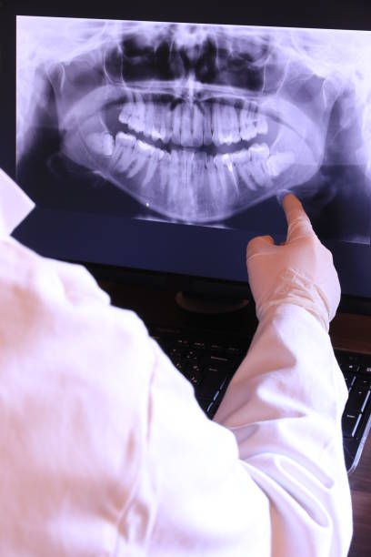 Best Emergency Tooth Extraction in Hrisburg, AR
