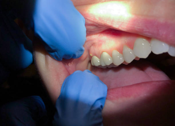 Best After-Hours Emergency Dentist in Hrisburg, AR