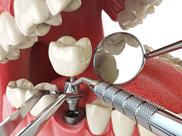 Best Emergency Dental Surgery in Hrisburg, AR